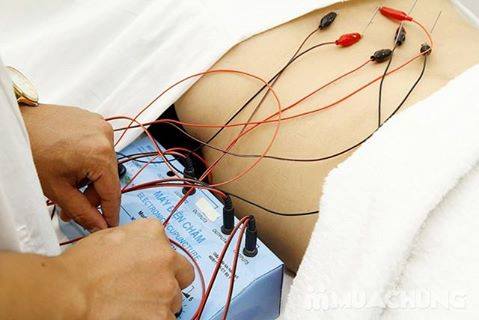 BÁC SĨ CHÂM CỨU, PHỤC HỒI CHỨC NĂNG TẠI NHÀ TP HCM