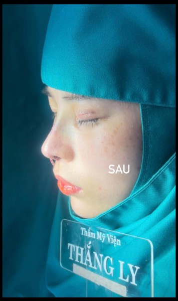 Cần hợp tác BS có CCHN Thẩm Mỹ Viện tại Buôn Ma Thuột ĐắkLắk