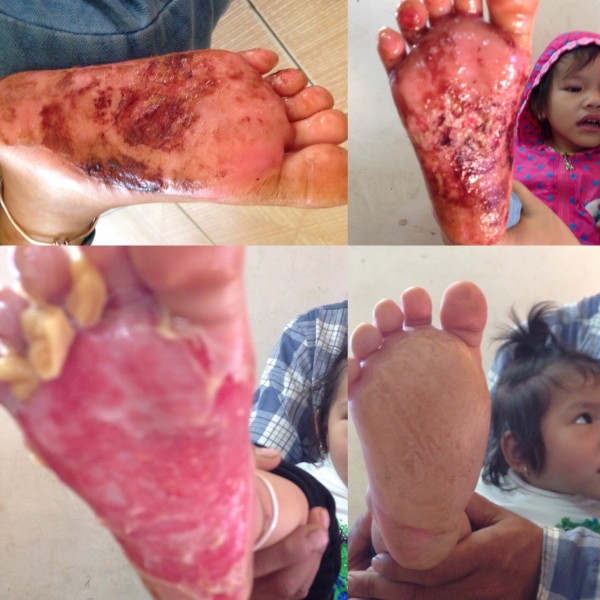 Cần thuê CCHN để mở phòng khám ngoại khoa bỏng