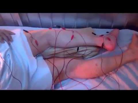 Châm cứu, vật lý trị liệu, tiêm truyền, BS đến tận nhà TP HCM